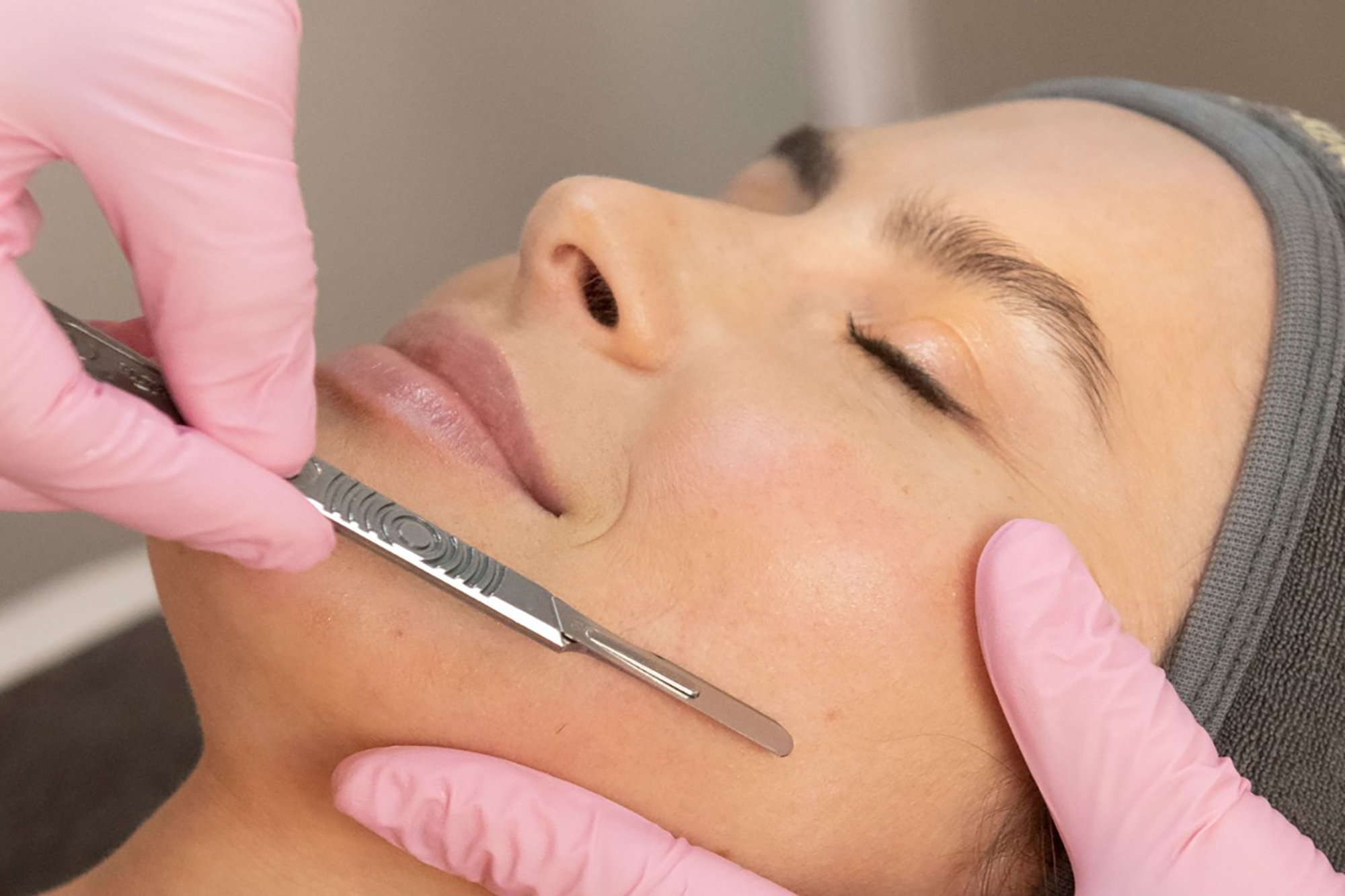 DERMAPLANNING